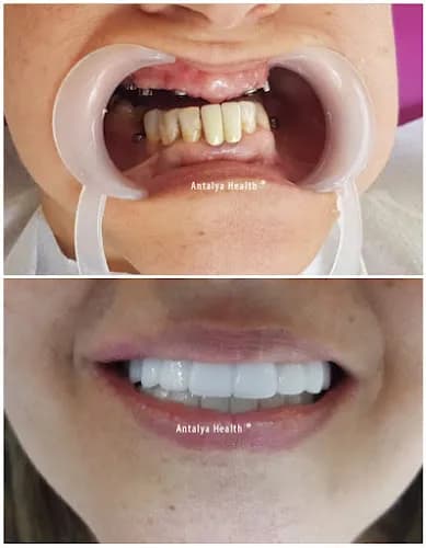 Dental Clinic Antalya kapak