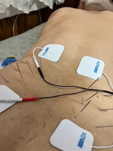 Fizyoterapist Melih Aras kapak