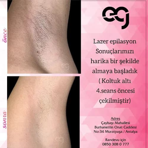 Ezgizem Beauty Güzellik Salonu Antalya kapak